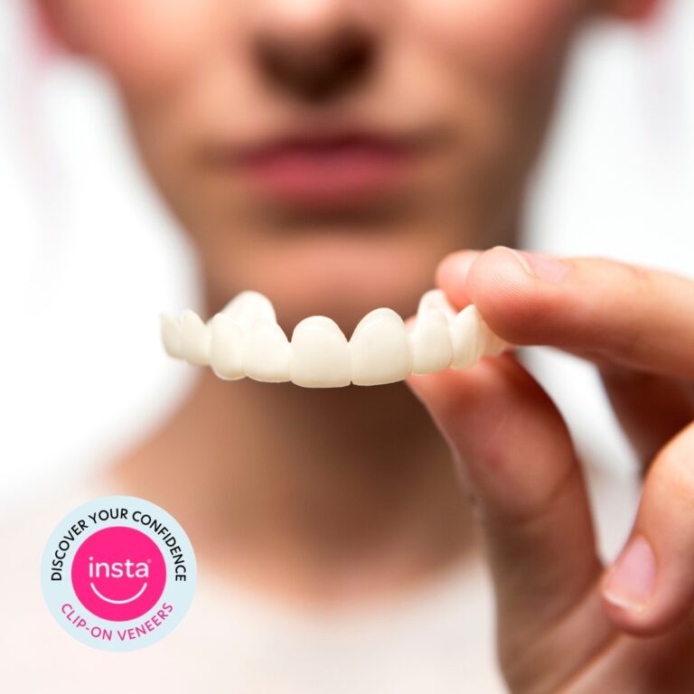 Instasmile Review: My Experience with Clip-On Veneers