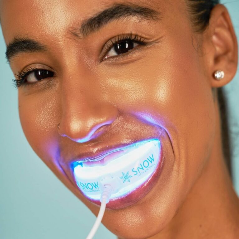 Snow Teeth Whitening Review: The Ultimate Guide to a Sparkling Smile