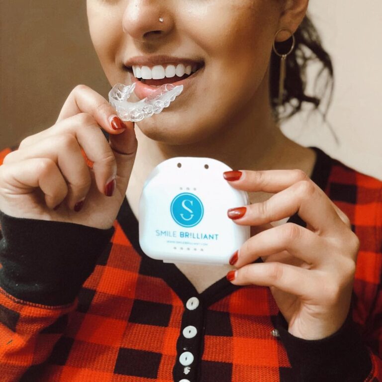 Smile Brilliant Review: My Honest Experience & Why I&lsquo;m Obsessed!