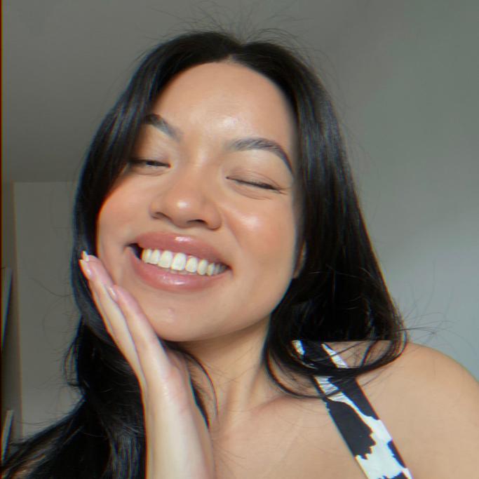 Smile Direct Club vs Candid: The Ultimate Aligner Showdown