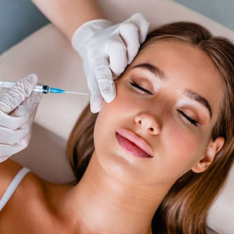 Cheek Filler Before and After: Achieving Youthful, Sculpted Cheeks with Dermal Fillers